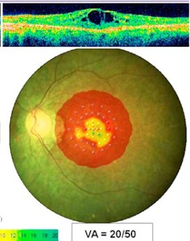 eye2010195f13